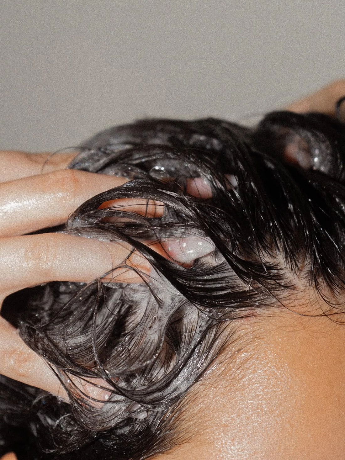 I'm worried about my scalp
