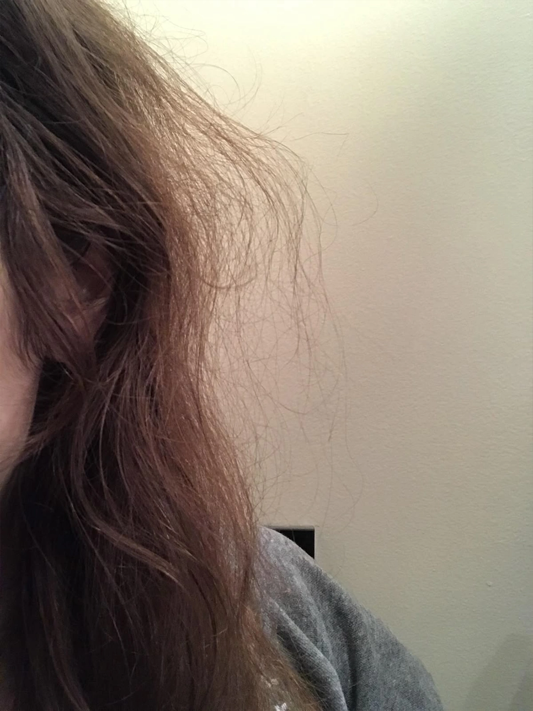 Hair that worries about the scalp