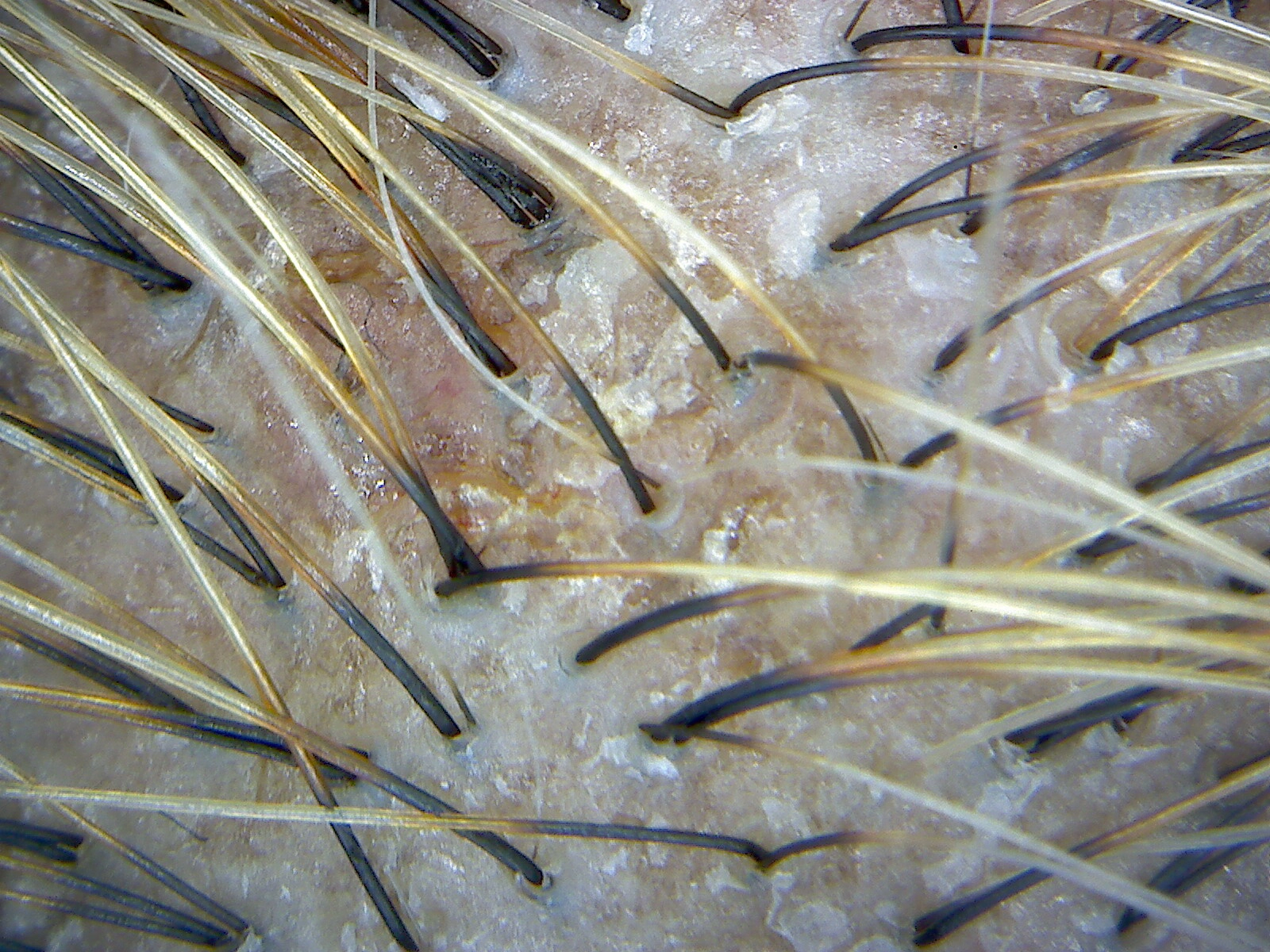 scalp diagnosis Before